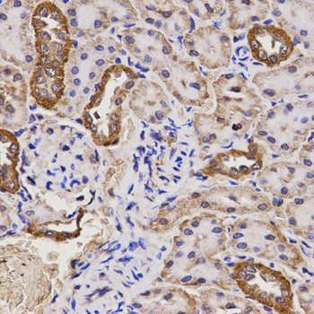 TAP2 Antibody - Immunohistochemistry of paraffin-embedded rat kidney using TAP2 antibody at dilution of 1:200 (x400 lens).