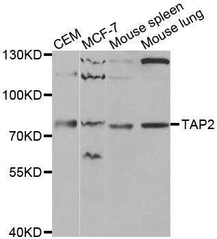 TAP2 Antibody - Western blot analysis of extracts of various cell lines, using TAP2 antibody at 1:1000 dilution. The secondary antibody used was an HRP Goat Anti-Rabbit IgG (H+L) at 1:10000 dilution. Lysates were loaded 25ug per lane and 3% nonfat dry milk in TBST was used for blocking.