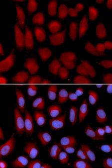TAP2 Antibody - Immunofluorescence analysis of U2OS cells using TAP2 antibody. Blue: DAPI for nuclear staining.