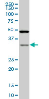 TARBP2 / TRBP2 Antibody - TARBP2 monoclonal antibody, clone 2G10. Western blot of TARBP2 expression in HeLa nuclear extract.