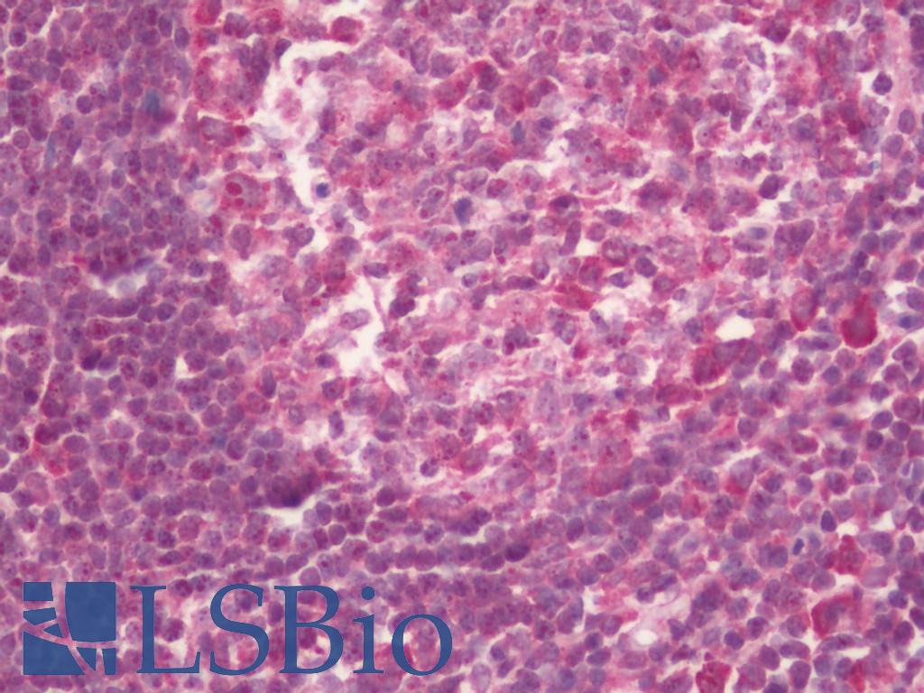 TARSH / ABI3BP Antibody - Human Tonsil: Formalin-Fixed, Paraffin-Embedded (FFPE)