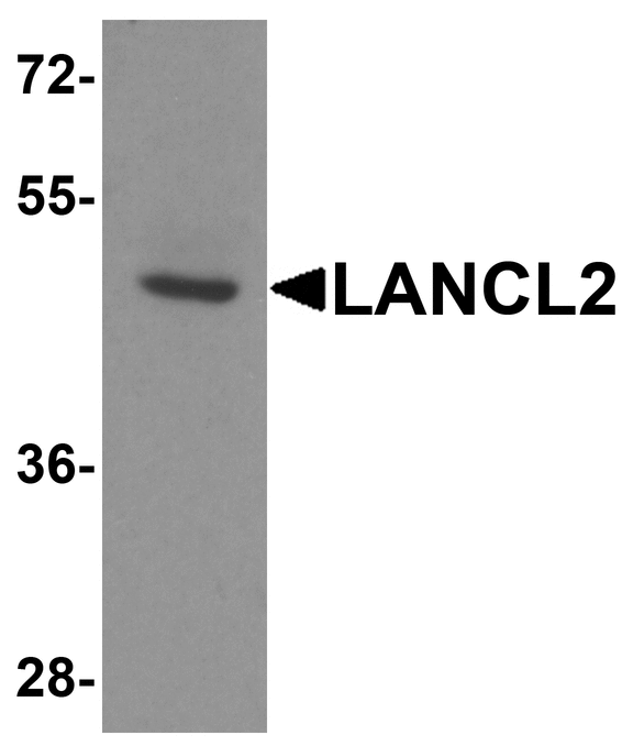TASP / LANCL2 Antibody - Western blot analysis of LANCL2 in human brain tissue lysate with LANCL2 antibody at 1 ug/ml.