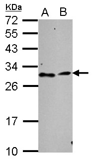 TATDN3 Antibody - Sample (30 ug of whole cell lysate) A: NT2D1 B: SK-N-SH 12% SDS PAGE TATDN3 antibody diluted at 1:1000