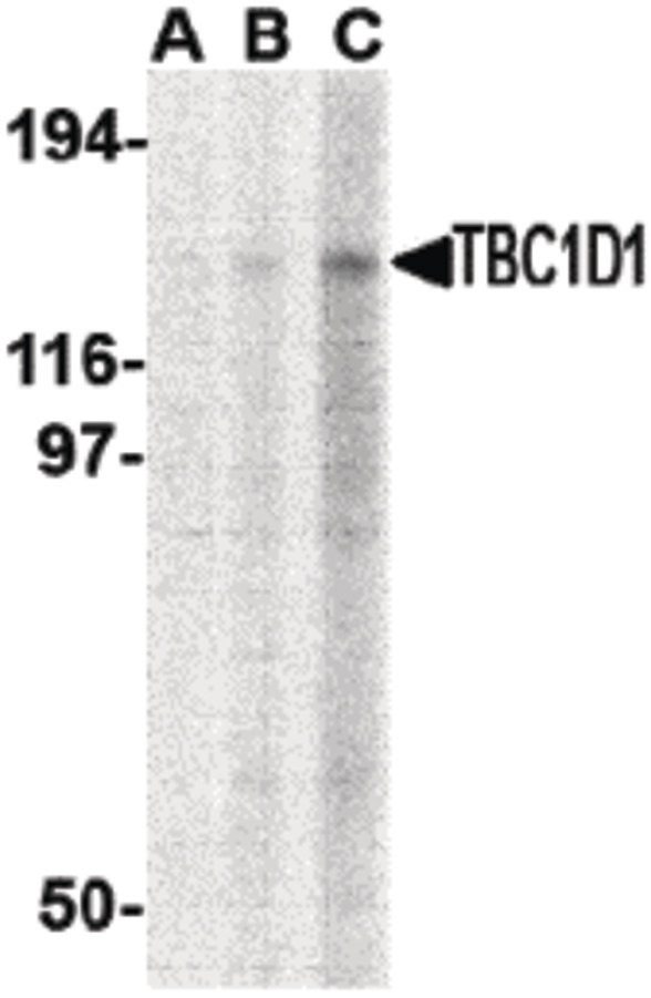 TBC1 / TBC1D1 Antibody - Western blot of TBC1D1 in Daudi cell lysate with TBC1D1 antibody at (A) 1, (B) 2 and (C) 4 ug/ml.