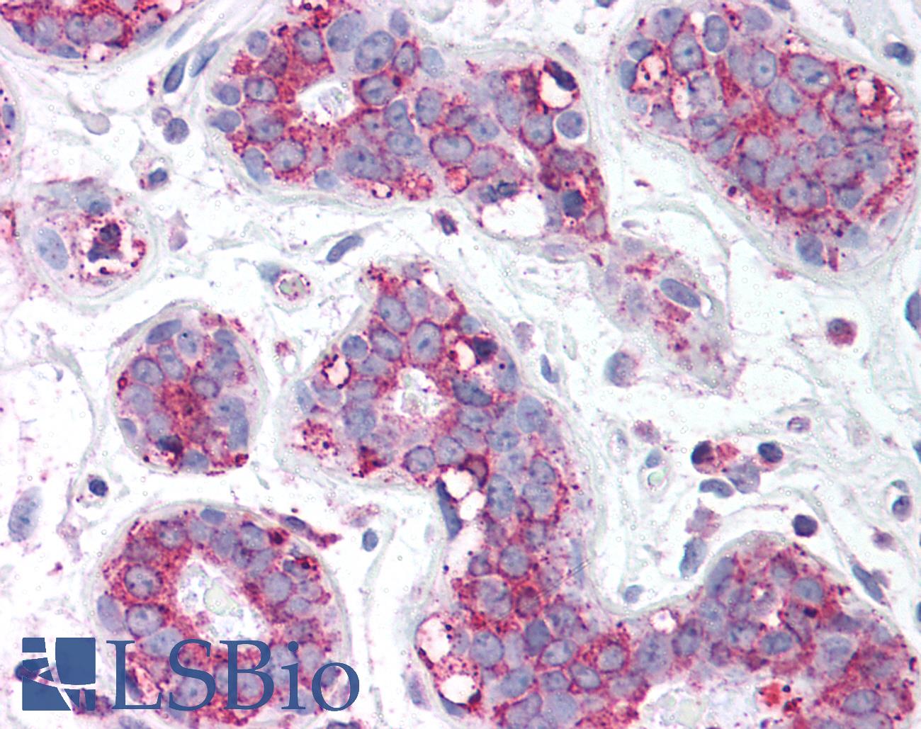 TBC1 / TBC1D1 Antibody - Anti-TBC1D1 antibody IHC of human breast. Immunohistochemistry of formalin-fixed, paraffin-embedded tissue after heat-induced antigen retrieval. Antibody concentration 5 ug/ml.