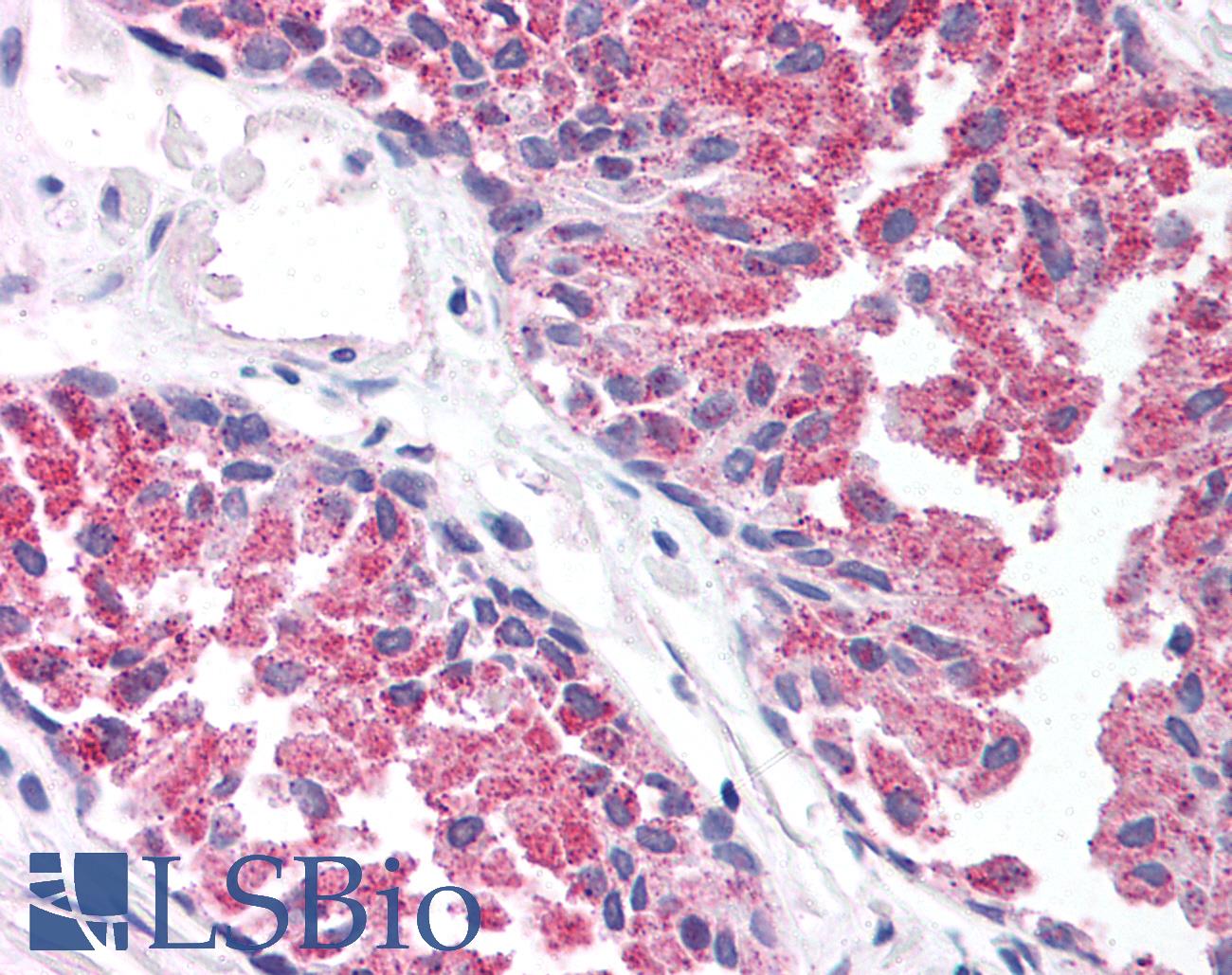 TBC1 / TBC1D1 Antibody - Anti-TBC1D1 antibody IHC of human prostate. Immunohistochemistry of formalin-fixed, paraffin-embedded tissue after heat-induced antigen retrieval. Antibody concentration 5 ug/ml.