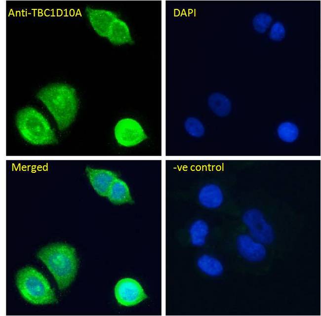 TBC1D10A Antibody - TBC1D10A antibody immunofluorescence analysis of paraformaldehyde fixed MCF7 cells, permeabilized with 0.15% Triton. Primary incubation 1hr (10ug/ml) followed by Alexa Fluor 488 secondary antibody (4ug/ml), showing cytoplasmic/Plasma Membrane and nuclear staining.