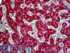 TBC1D10A Antibody - Anti-TBC1D10A antibody IHC of human liver. Immunohistochemistry of formalin-fixed, paraffin-embedded tissue after heat-induced antigen retrieval. Antibody concentration 4.75 ug/ml.