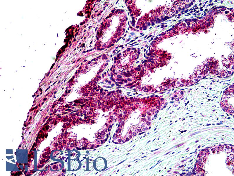 TBC1D10A Antibody - Anti-TBC1D10A antibody IHC of human prostate. Immunohistochemistry of formalin-fixed, paraffin-embedded tissue after heat-induced antigen retrieval. Antibody concentration 4.75 ug/ml.