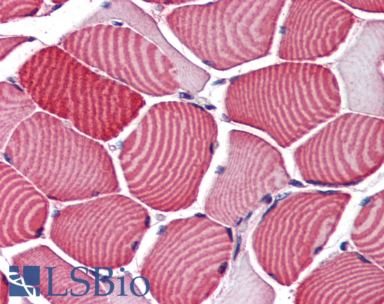 TBC1D4 / AS160 Antibody - Anti-TBC1D4 antibody IHC of human skeletal muscle. Immunohistochemistry of formalin-fixed, paraffin-embedded tissue after heat-induced antigen retrieval. Antibody concentration 75 ug/ml.