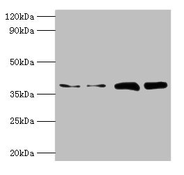 TBCC Antibody - Western blot All lanes: Tubulin-specific chaperone C antibody at 2µg/ml Lane 1: Mouse brain tissue Lane 2: Hela whole cell lysate Lane 3: NIH/3T3 whole cell lysate Lane 4: A431 whole cell lysate Secondary Goat polyclonal to rabbit IgG at 1/10000 dilution Predicted band size: 39 kDa Observed band size: 39 kDa
