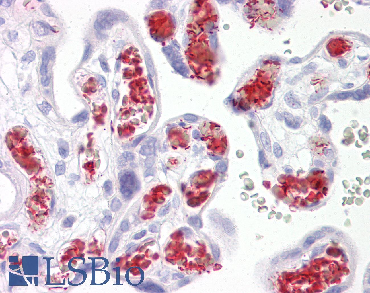 TBKBP1 Antibody - Anti-TBKBP1 antibody IHC of human placenta. Immunohistochemistry of formalin-fixed, paraffin-embedded tissue after heat-induced antigen retrieval. Antibody concentration 10 ug/ml.