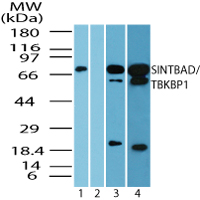 TBKBP1 Antibody - Western blot of SINTBAD/TBKBP1 in human brain lysate in the 1) absence and 2) presence of immunizing peptide 3) mouse brain and 4) rat brain using TBKBP1 Antibody at 4.0 ug/ml, 0.5 ug/ml and 1.0 ug/ml, respectively. Goat anti-rabbit Ig HRP secondary antibody, and PicoTect ECL substrate solution, were used for this test.