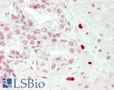 TBPL2 / TRF3 Antibody - Human Prostate: Formalin-Fixed, Paraffin-Embedded (FFPE)