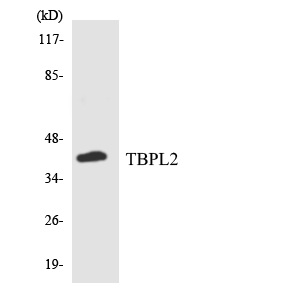 TBPL2 / TRF3 Antibody - Western blot analysis of the lysates from COLO205 cells using TBPL2 antibody.
