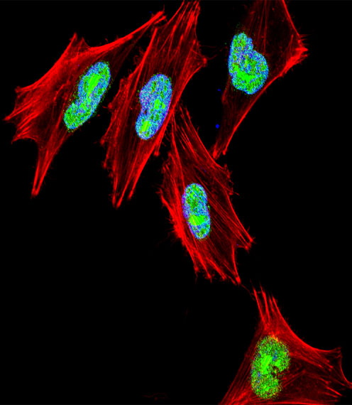 TBX1 Antibody - Fluorescent confocal image of A2058 cell stained with TBX1 Antibody. A2058 cells were fixed with 4% PFA (20 min), permeabilized with Triton X-100 (0.1%, 10 min), then incubated with TBX1 primary antibody (1:25, 1 h at 37°C). For secondary antibody, Alexa Fluor 488 conjugated donkey anti-rabbit antibody (green) was used (1:400, 50 min at 37°C). Cytoplasmic actin was counterstained with Alexa Fluor 555 (red) conjugated Phalloidin (7units/ml, 1 h at 37°C). Nuclei were counterstained with DAPI (blue) (10 ug/ml, 10 min). TBX1 immunoreactivity is localized to nucleus significantly.