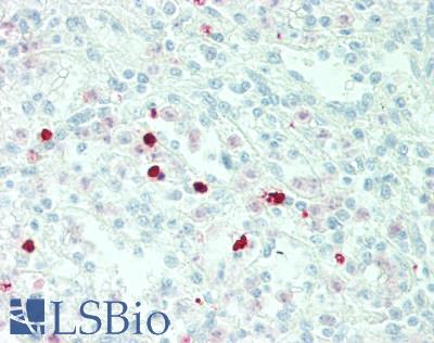 TBX1 Antibody - Human Spleen: Formalin-Fixed, Paraffin-Embedded (FFPE)