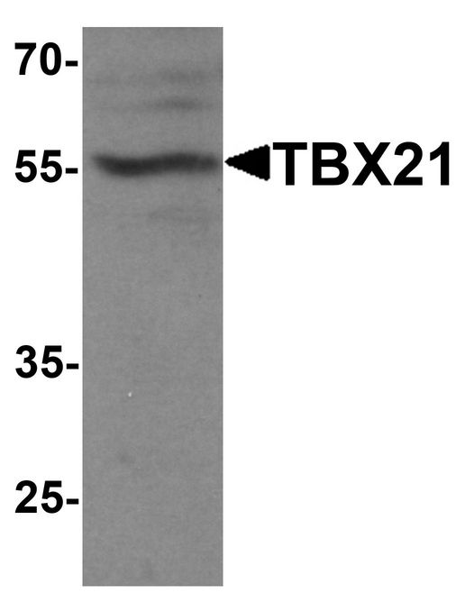 TBX21 / T-bet Antibody - Western blot analysis of TBX21 in 293 cell lysate with TBX21 antibody at 1 ug/ml.
