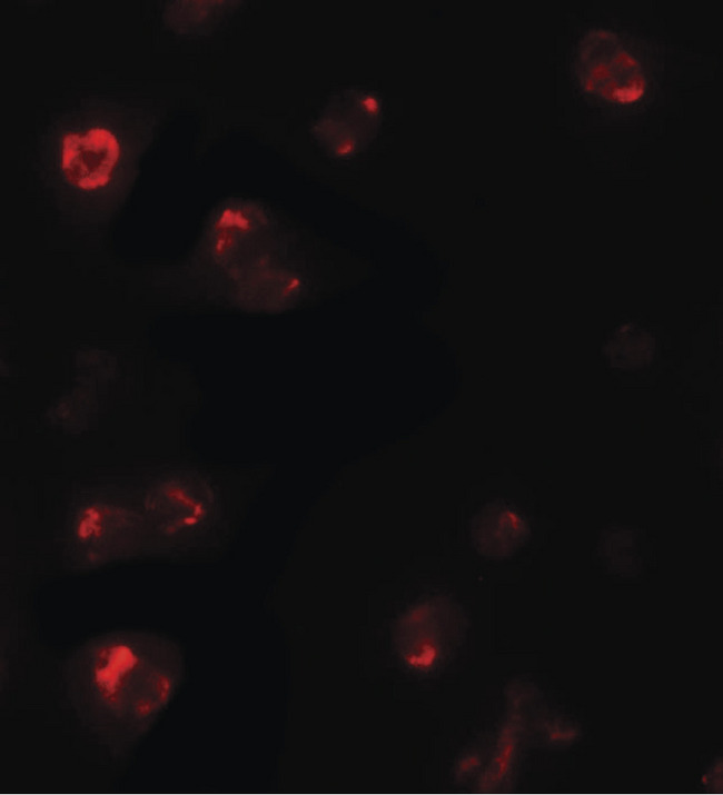 TBX21 / T-bet Antibody - Immunofluorescence of TBX21 in 293 cells with TBX21 antibody at 5 ug/ml.