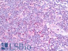 TBX21 / T-bet Antibody - Anti-TBX21 / T-bet antibody IHC staining of human tonsil. Immunohistochemistry of formalin-fixed, paraffin-embedded tissue after heat-induced antigen retrieval. Antibody concentration 10 ug/ml.