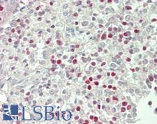 TBX21 / T-bet Antibody - Human Spleen: Formalin-Fixed, Paraffin-Embedded (FFPE)