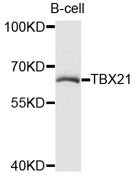 TBX21 / T-bet Antibody - Western blot analysis using TBX21 antibody.