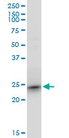 TC21 / RRAS2 Antibody - RRAS2 monoclonal antibody, clone 2D3-4B8. Western blot of RRAS2 expression in NIH/3T3.