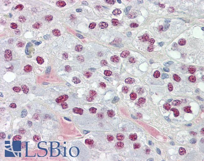 TCEAL3+5+6 Antibody - Anti-TCEAL3/5/6 antibody IHC of human adrenal. Immunohistochemistry of formalin-fixed, paraffin-embedded tissue after heat-induced antigen retrieval. Antibody dilution 5 ug/ml.
