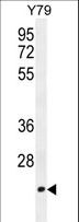 TCEAL3 Antibody - TCAL3 Antibody western blot of Y79 cell line lysates (35 ug/lane). The TCAL3 antibody detected the TCAL3 protein (arrow).