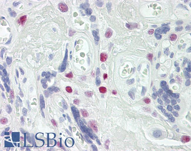 TCEAL4 Antibody - Anti-TCEAL4 antibody IHC of human placenta. Immunohistochemistry of formalin-fixed, paraffin-embedded tissue after heat-induced antigen retrieval. Antibody dilution 5 ug/ml.