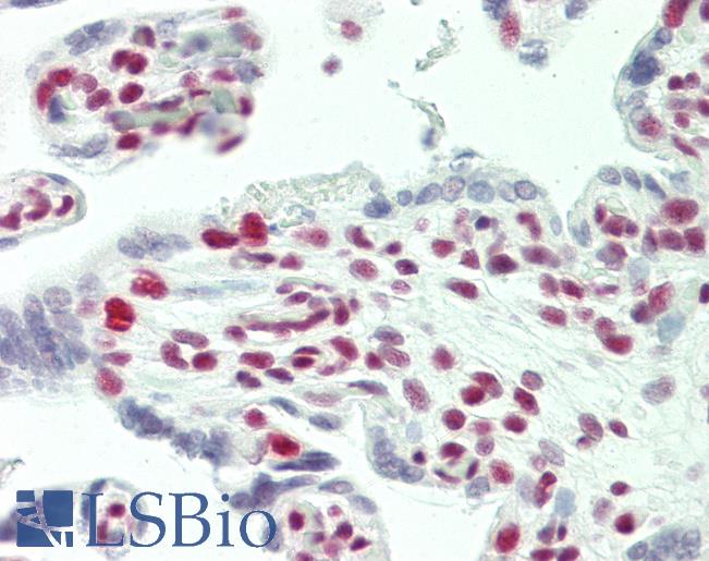 TCERG1 / CA150 Antibody - Anti-TCERG1 / CA150 antibody IHC staining of human placenta. Immunohistochemistry of formalin-fixed, paraffin-embedded tissue after heat-induced antigen retrieval. Antibody concentration 5 ug/ml.