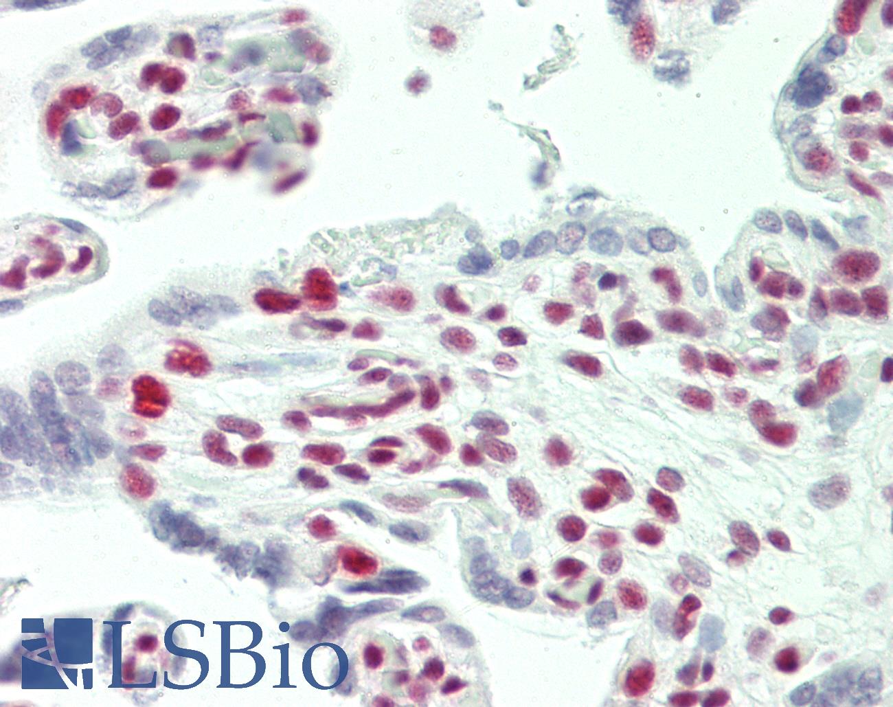 TCERG1 / CA150 Antibody - Anti-TCERG1 / CA150 antibody IHC staining of human placenta. Immunohistochemistry of formalin-fixed, paraffin-embedded tissue after heat-induced antigen retrieval. Antibody concentration 5 ug/ml.