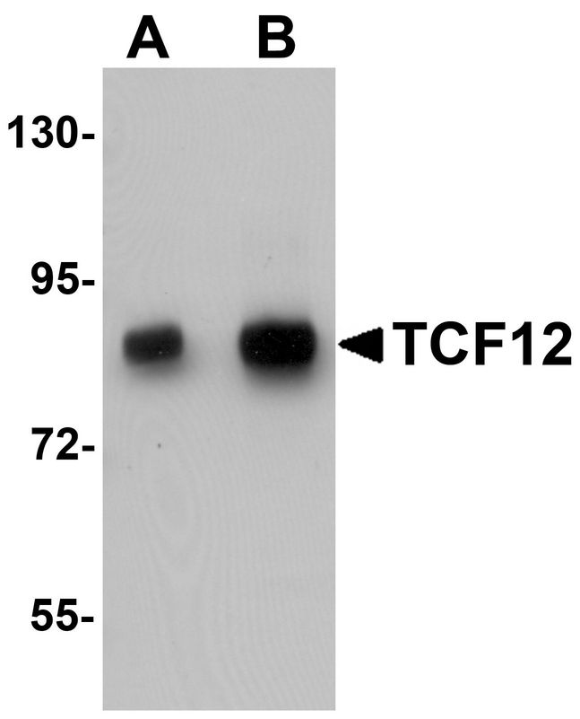 TCF12 / HEB Antibody - Western blot analysis of TCF12 in HeLa cell lysate with TCF12 antibody at (A) 0.5 and (B) 1 ug/ml.