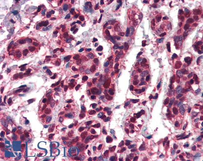 TCF3 / E2A Antibody - Anti-TCF3 antibody IHC of human breast. Immunohistochemistry of formalin-fixed, paraffin-embedded tissue after heat-induced antigen retrieval. Antibody concentration 75 ug/ml.