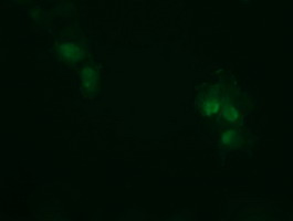 TCL / RHOJ Antibody - Anti-RHOJ mouse monoclonal antibody immunofluorescent staining of COS7 cells transiently transfected by pCMV6-ENTRY RHOJ.