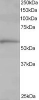 TCP1 Antibody - TCP1 antibody staining (1 ug/ml) of Human Lung lysate (RIPA buffer, 35g total protein per lane). Primary incubated for 1 hour. Detected by Western blot of chemiluminescence.