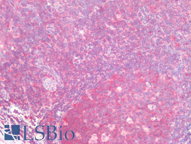 TCP1 Antibody - Human Tonsil: Formalin-Fixed, Paraffin-Embedded (FFPE)