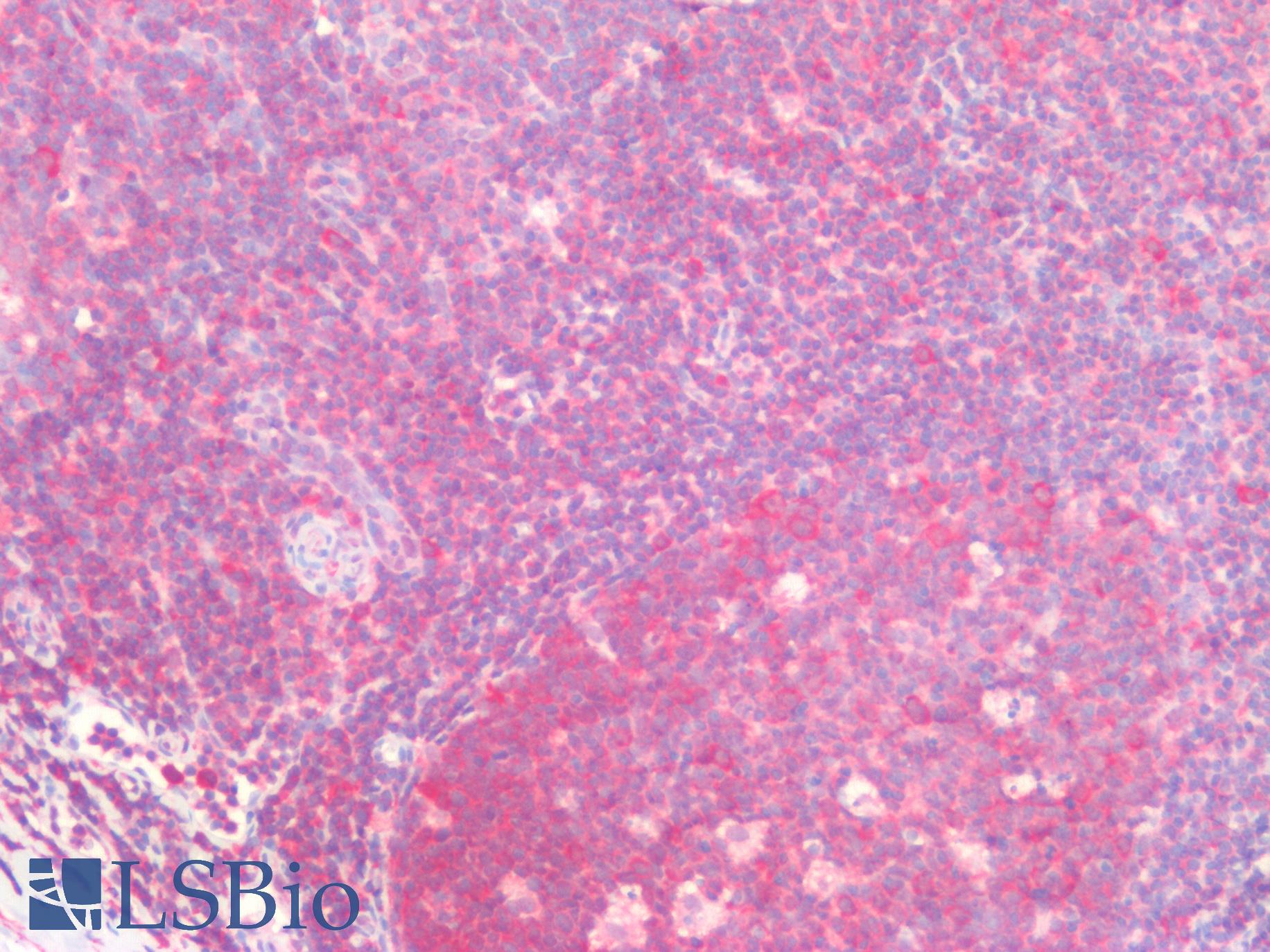 TCP1 Antibody - Human Tonsil: Formalin-Fixed, Paraffin-Embedded (FFPE)