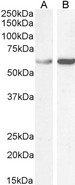 TCP1 Antibody - Goat Anti-TCP1 Antibody (1µg/ml) staining of Human Ovary (A) lysate and HEK293 (B) cell lysate (35µg protein in RIPA buffer). Detected by chemiluminescencence.
