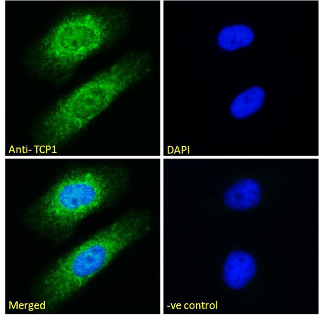 TCP1 Antibody - Goat Anti-TCP1 Antibody Immunofluorescence analysis of paraformaldehyde fixed HeLa cells, permeabilized with 0.15% Triton. Primary incubation 1hr (10ug/ml) followed by Alexa Fluor 488 secondary antibody (2ug/ml), showing cytoplasmic and nuclear staining. The nuclear stain is DAPI (blue). Negative control: Unimmunized goat IgG (10ug/ml) followed by Alexa Fluor 488 secondary antibody (2ug/ml).