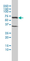 TCP1 Antibody - TCP1 monoclonal antibody (M01), clone 2B2-D6 Western blot of TCP1 expression in HeLa.