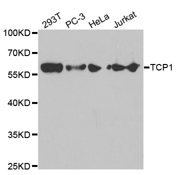 TCP1 Antibody - Western blot analysis of extracts of various cell lines, using TCP1 antibody.