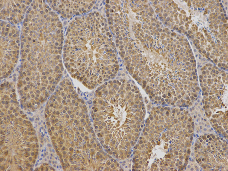 TCP1 Antibody - Immunohistochemistry of paraffin-embedded mouse testis using TCP1 antibody at dilution of 1:100 (200x lens).