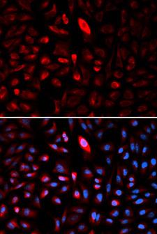 TCP1 Antibody - Immunofluorescence analysis of U2OS cell using TCP1 antibody. Blue: DAPI for nuclear staining.