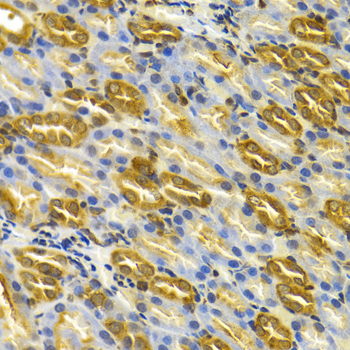 TCP1 Antibody - Immunohistochemistry of paraffin-embedded rat kidney tissue.