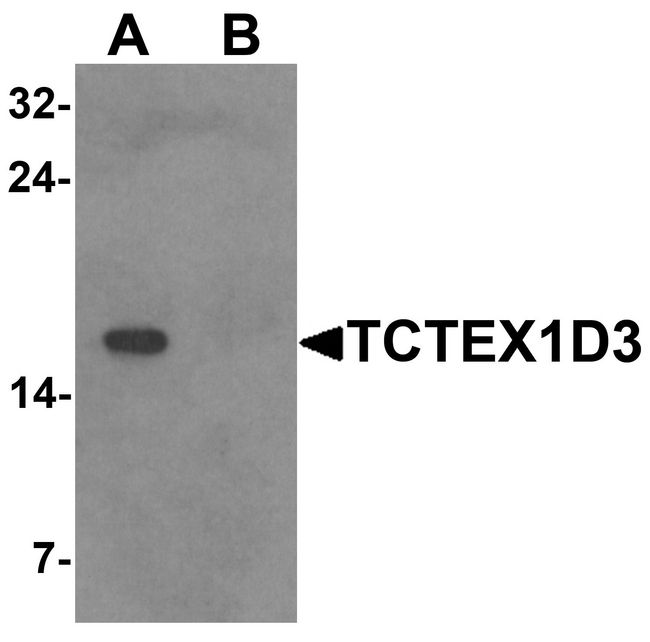 TCTE3 Antibody - Western blot analysis of TCTEX1D3 in EL4 cell lysate with TCTEX1D3 antibody at 1 ug/ml in (A) the absence and (B) the presence of blocking peptide.