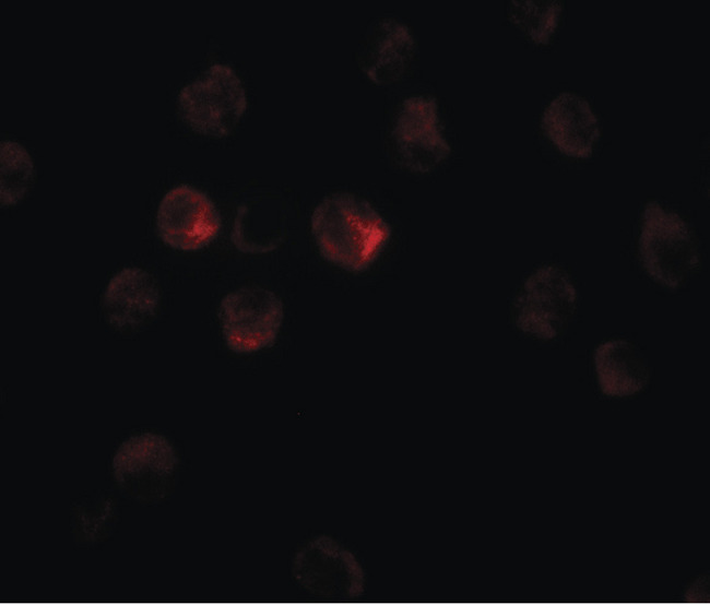 TCTEX1D1 Antibody - Immunofluorescence of TCTEX1D1 in K562 cells with TCTEX1D1 antibody at 20 ug/ml.