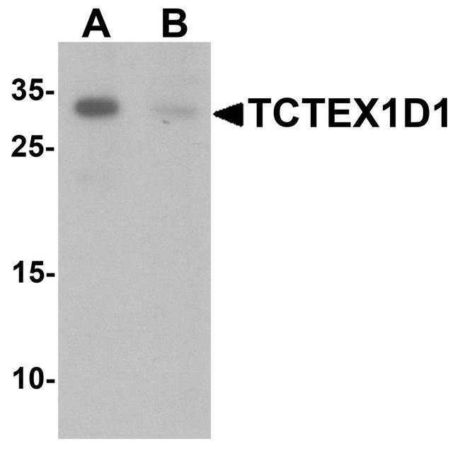 TCTEX1D1 Antibody - Western blot analysis of TCTEX1D1 in K562 cell lysate with TCTEX1D1 antibody at 1 ug/ml in (A) the absence and (B) the presence of blocking peptide.