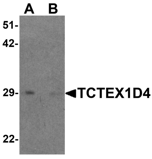 TCTEX1D4 Antibody - Western blot analysis of TCTEX1D4 in mouse liver tissue lysate with TCTEX1D4 antibody at 1 ug/ml in (A) the absence and (B) the presence of blocking peptide.