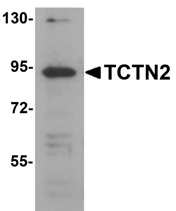 TCTN2 Antibody - Western blot analysis of TCTN2 in SK-N-SH cell lysate with TCTN2 antibody at 1 ug/ml.